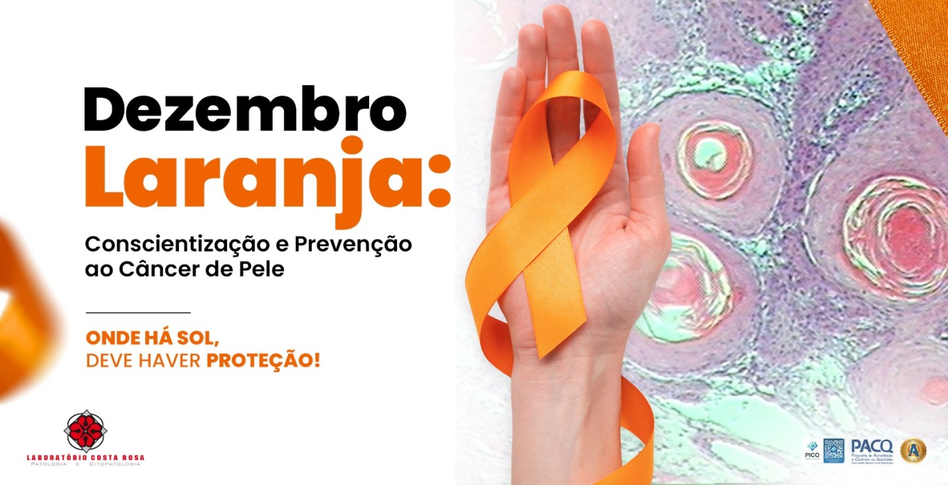 DEZEMBRO LARANJA: MÊS DE CONSCIENTIZAÇÃO E PREVENÇÃO AO CÂNCER DE PELE