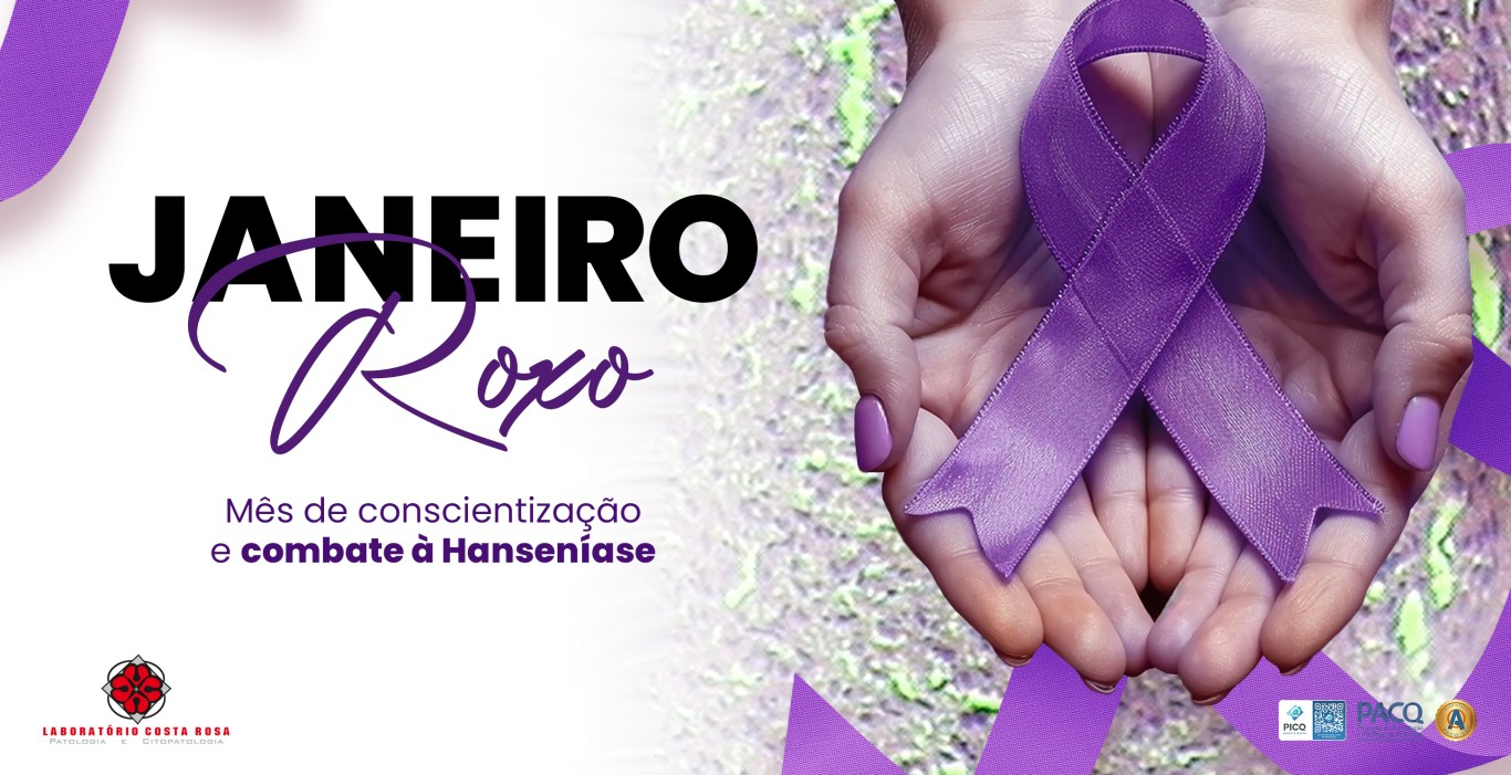 JANEIRO ROXO: MÊS DE CONSCIENTIZAÇÃO SOBRE A HANSENÍASE E A IMPORTÂNCIA DO DIAGNÓSTICO PRECOCE