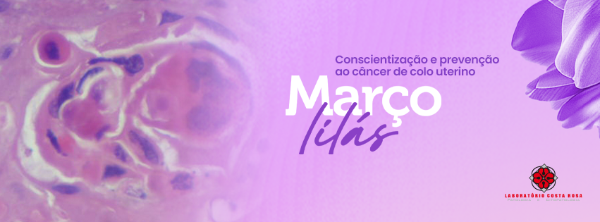 Março Lilás: Conscientização sobre o Câncer do Colo do Útero