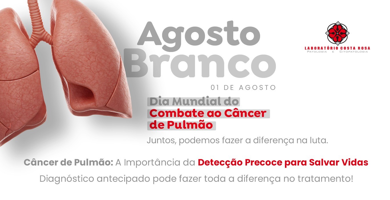 Agosto Branco dia Combate ao Câncer de pulmão