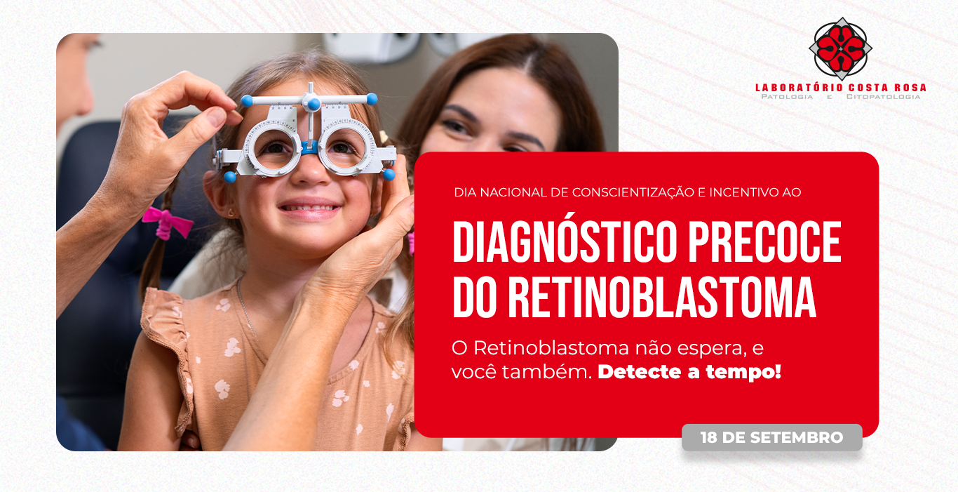 Não Deixe Passar: Retinoblastoma Tem Sinais Visíveis