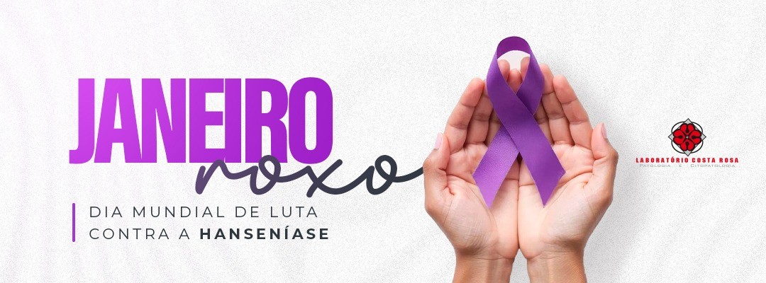 Dia Mundial Contra Hanseníase